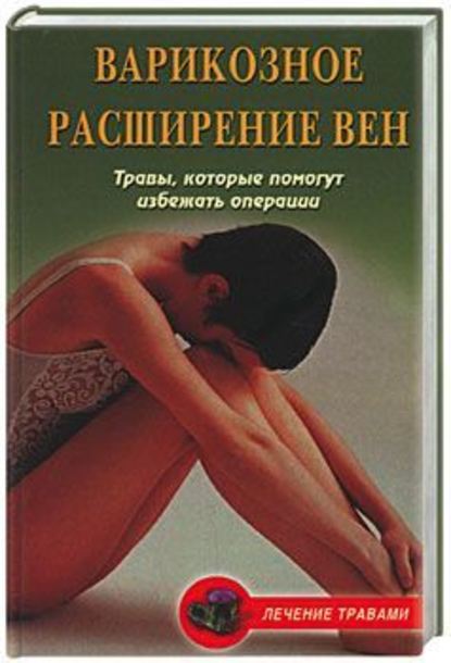 Варикозное расширение вен. Травы, которые помогут избежать операции — Ольга Абрамович