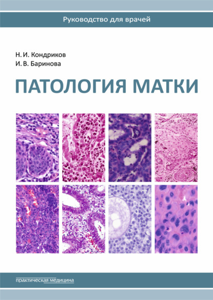 Патология матки. Руководство для врачей - Николай Кондриков