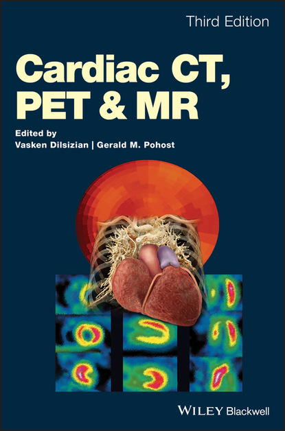 Cardiac CT, PET and MR - Группа авторов