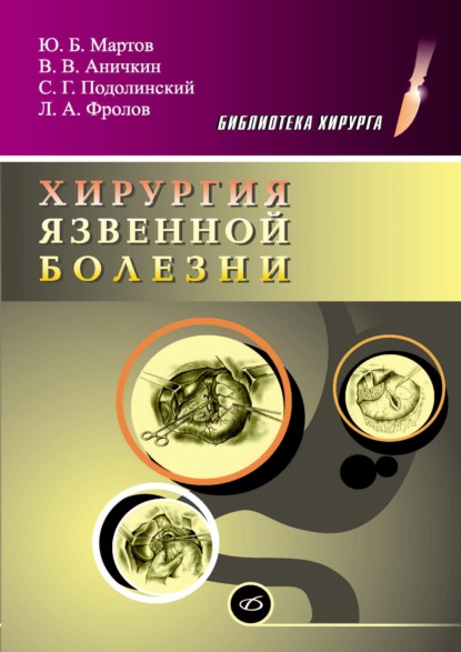 Хирургия язвенной болезни — Леонид Фролов