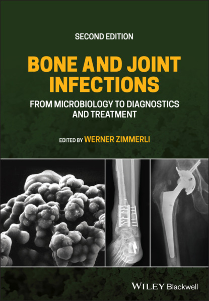 Bone and Joint Infections - Группа авторов