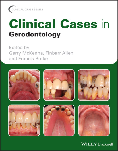 Clinical Cases in Gerodontology - Группа авторов