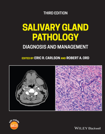 Salivary Gland Pathology - Группа авторов