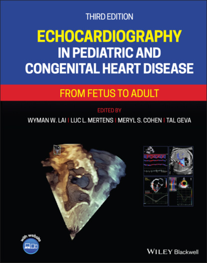 Echocardiography in Pediatric and Congenital Heart Disease - Группа авторов