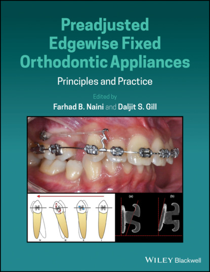 Preadjusted Edgewise Fixed Orthodontic Appliances - Группа авторов