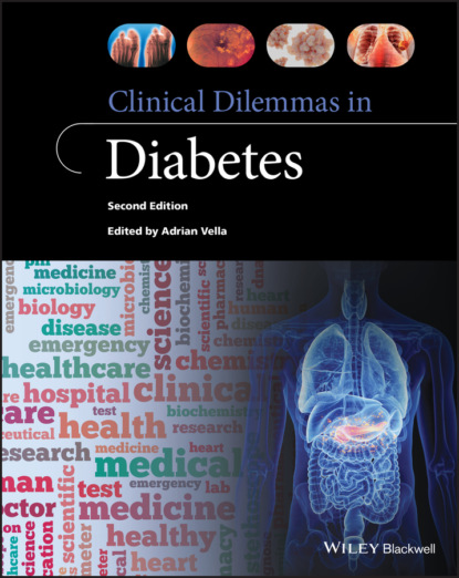 Clinical Dilemmas in Diabetes - Группа авторов