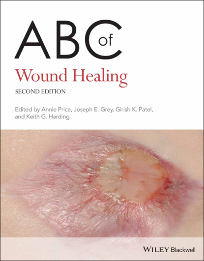 ABC of Wound Healing - Группа авторов