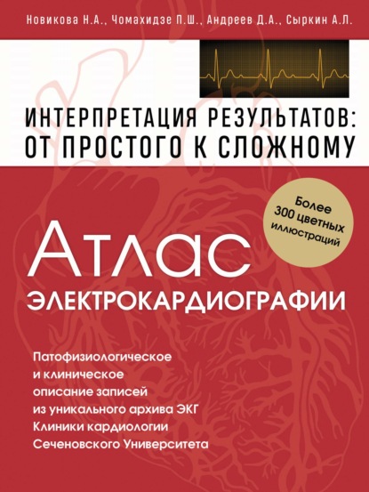 Атлас электрокардиографии. Интерпретация результатов: от простого к сложному - Петр Чомахидзе