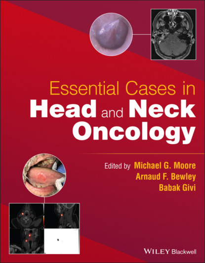 Essential Cases in Head and Neck Oncology - Группа авторов