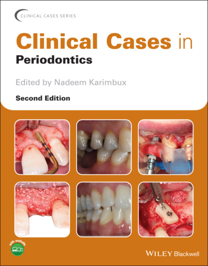 Clinical Cases in Periodontics - Группа авторов