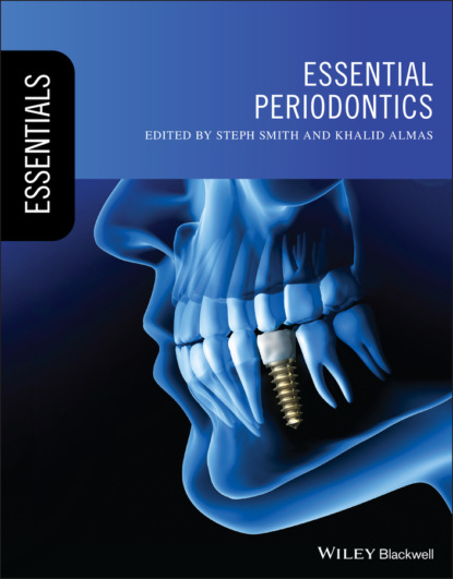 Essential Periodontics - Группа авторов