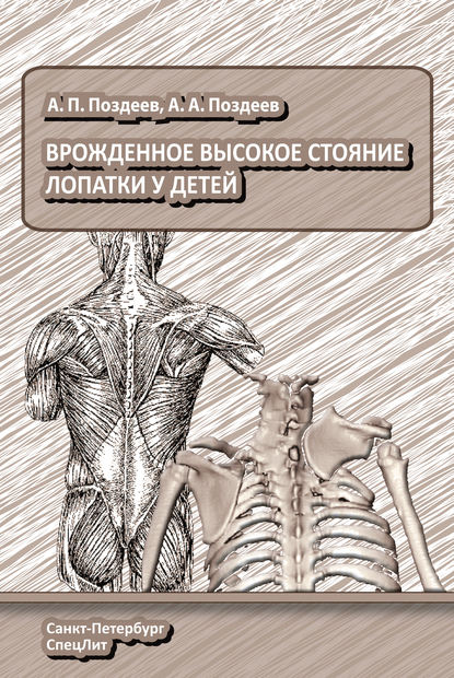 Врожденное высокое стояние лопатки у детей — А. А. Поздеев