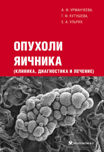 Опухоли яичника: клиника, диагностика и лечение - Е. А. Ульрих