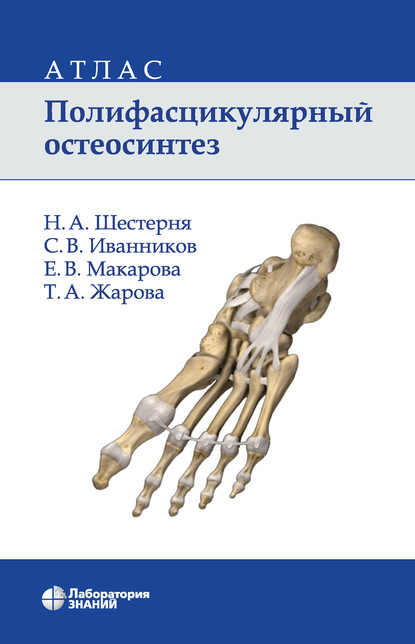 Полифасцикулярный остеосинтез. Атлас — Н. А. Шестерня