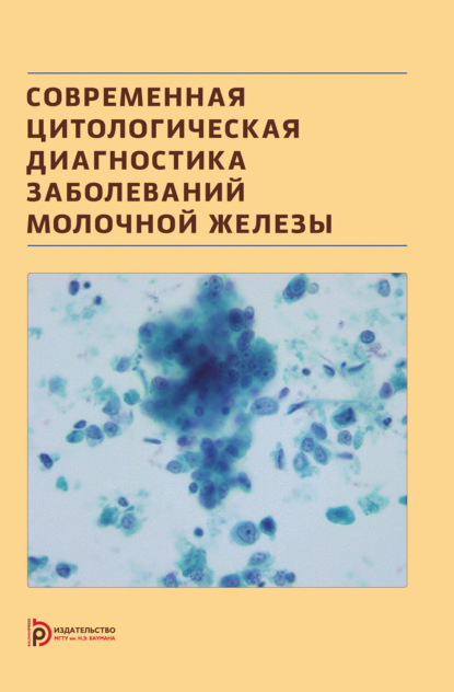 Современная цитологическая диагностика заболеваний молочной железы - Надежда Волченко