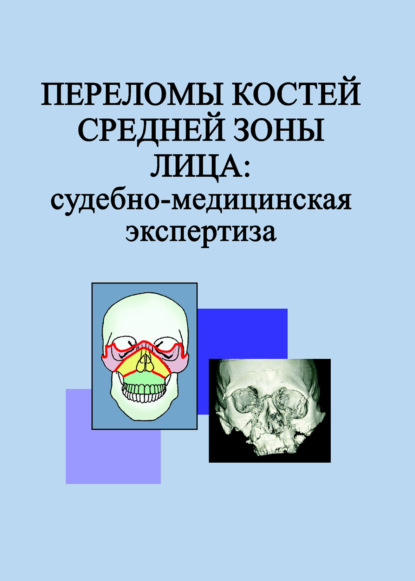 Переломы костей средней зоны лица: судебно-медицинская экспертиза - Л. Н. Гришенкова