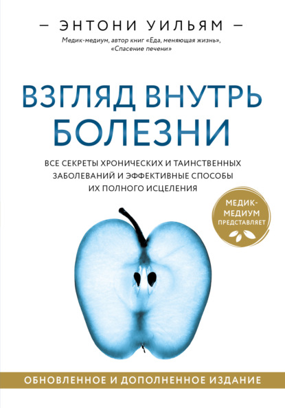 Взгляд внутрь болезни. Все секреты хронических и таинственных заболеваний и эффективные способы их полного исцеления - Энтони Уильям