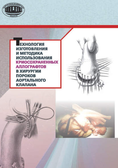 Технология изготовления и методика использования криосохраненных аллографтов в хирургии пороков аортального клапана - Ю. П. Островский