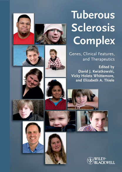 Tuberous Sclerosis Complex - Группа авторов