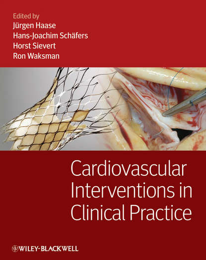 Cardiovascular Interventions in Clinical Practice — Группа авторов