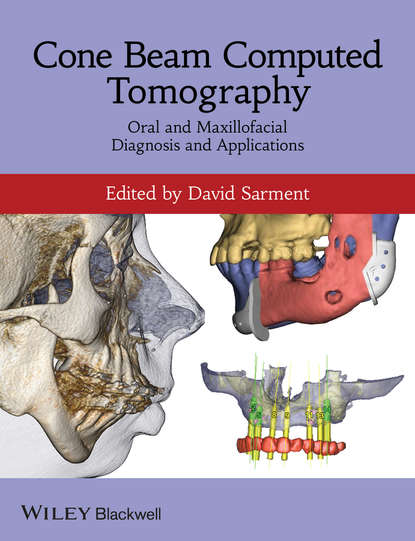 Cone Beam Computed Tomography - Группа авторов