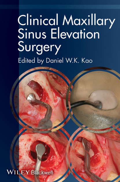 Clinical Maxillary Sinus Elevation Surgery - Группа авторов