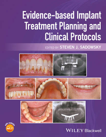 Evidence-based Implant Treatment Planning and Clinical Protocols - Группа авторов