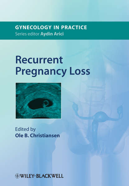 Recurrent Pregnancy Loss - Группа авторов