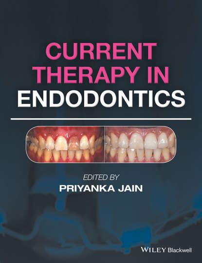 Current Therapy in Endodontics - Группа авторов