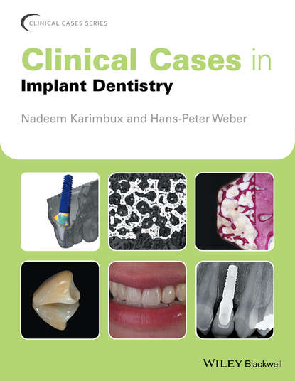 Clinical Cases in Implant Dentistry - Группа авторов