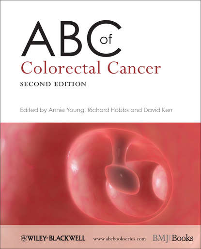 ABC of Colorectal Cancer - Группа авторов