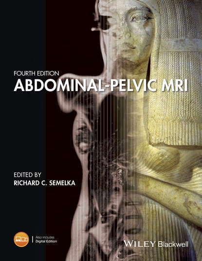 Abdominal-Pelvic MRI — Группа авторов