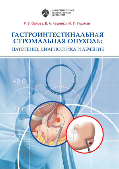 Гастроинтестинальная стромальная опухоль. Патогенез, диагностика и лечение - Р. В. Орлова