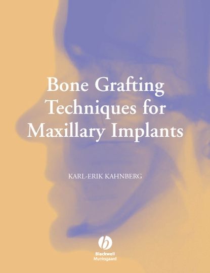 Bone Grafting Techniques for Maxillary Implants — Группа авторов