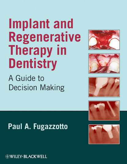 Implant and Regenerative Therapy in Dentistry - Группа авторов