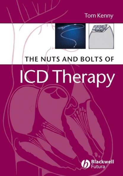 The Nuts and Bolts of ICD Therapy — Группа авторов