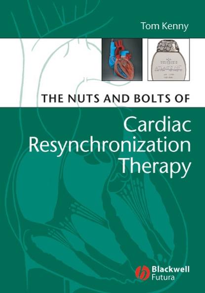 The Nuts and Bolts of Cardiac Resynchronization Therapy - Группа авторов