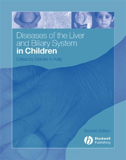 Diseases of the Liver and Biliary System in Children - Группа авторов