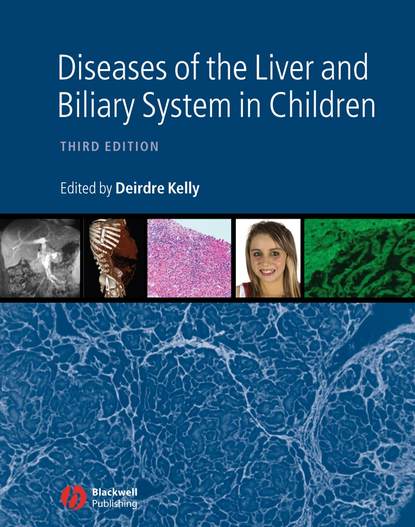 Diseases of the Liver and Biliary System in Children - Группа авторов