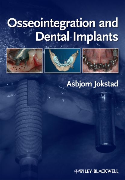 Osseointegration and Dental Implants — Группа авторов