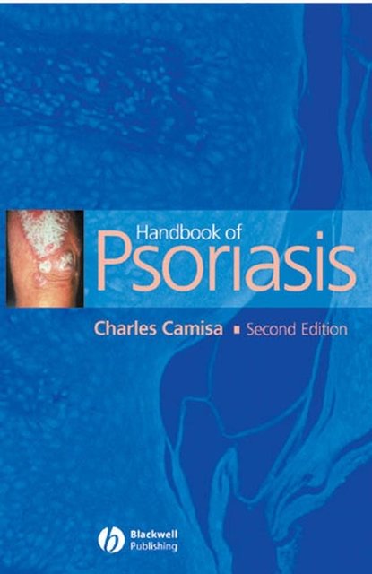 Handbook of Psoriasis - Группа авторов