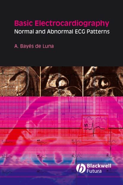 Basic Electrocardiography - Группа авторов