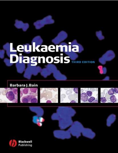 Leukaemia Diagnosis — Группа авторов