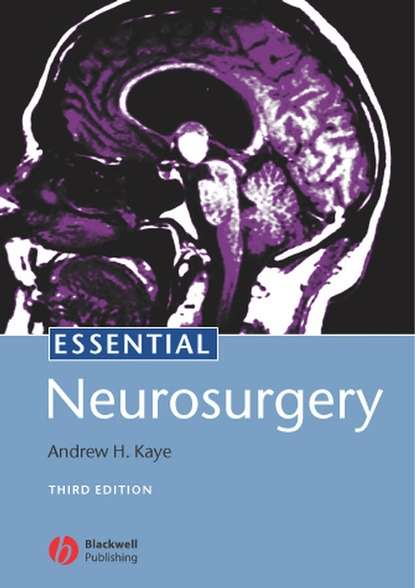 Essential Neurosurgery - Группа авторов