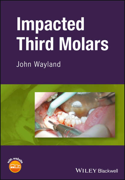 Impacted Third Molars — Группа авторов