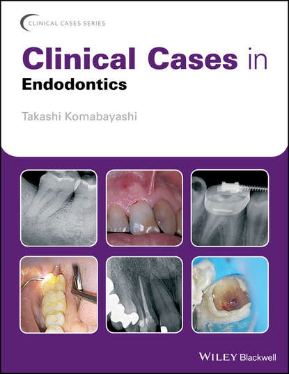 Clinical Cases in Endodontics - Группа авторов