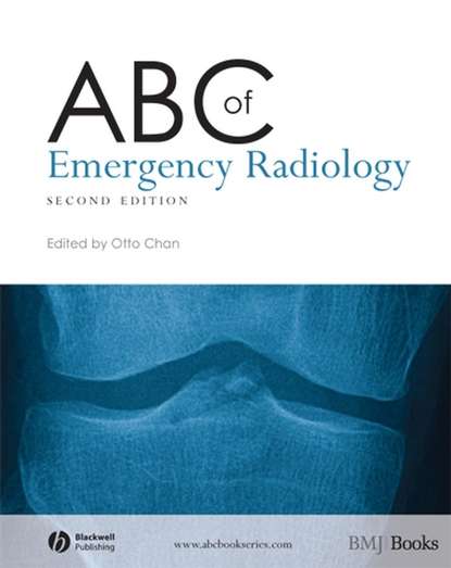 ABC of Emergency Radiology — Группа авторов