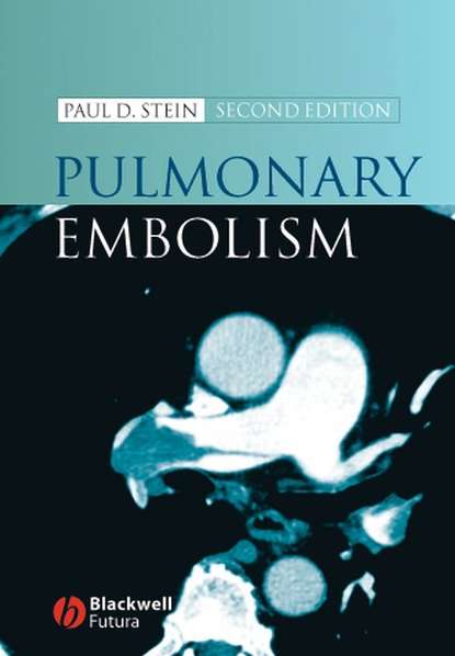 Pulmonary Embolism - Группа авторов