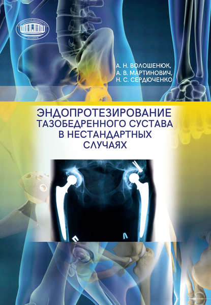 Эндопротезирование тазобедренного сустава в нестандартных случаях - Александр Волошенюк